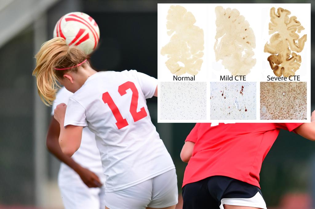 Common motion used in football may cause CTE-like brain damage: study